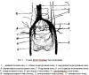 Схема флебограммы таза женщины