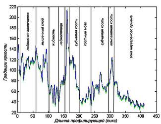 Рис. 3. Профиль яркости исследуемого изображения